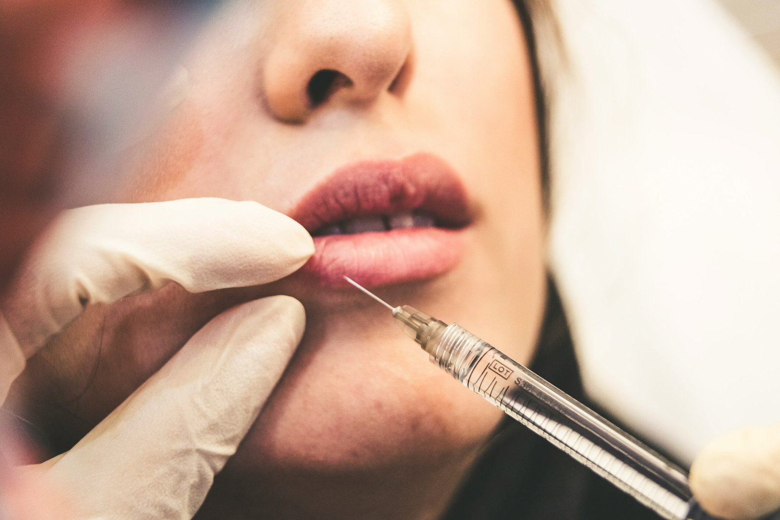 Relleno Labial: El Secreto de una Boca Atractiva